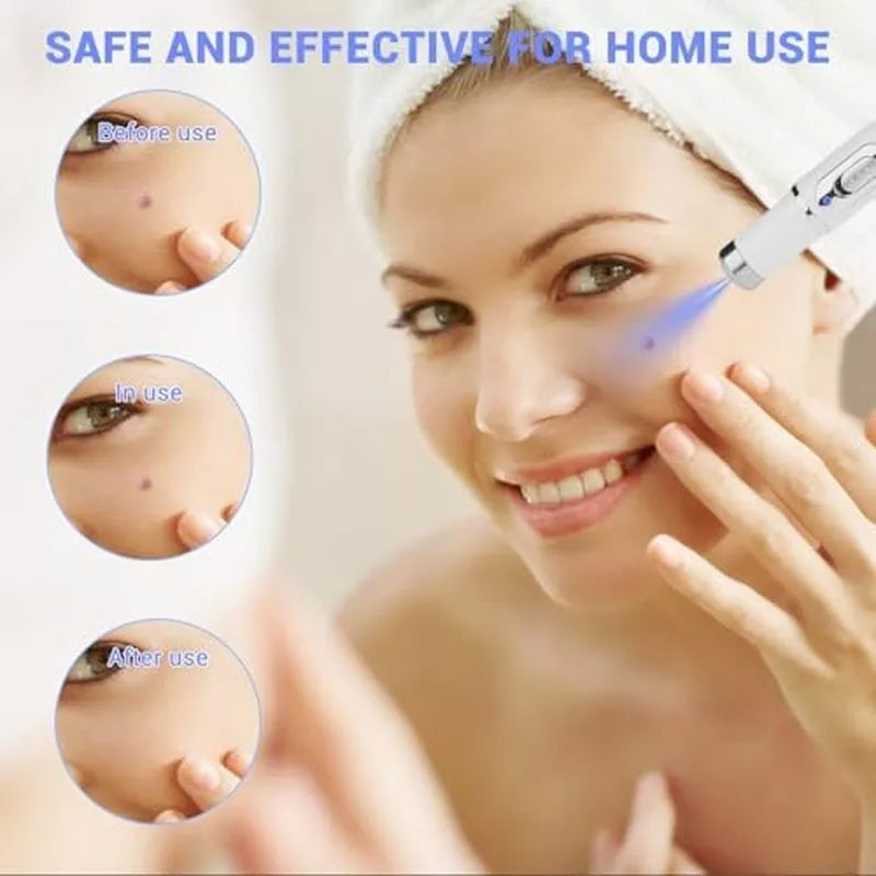 Blue LED Light Therapy Device for Acne and Skin Care